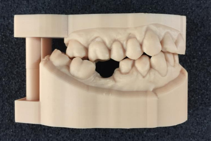 modelli dentali