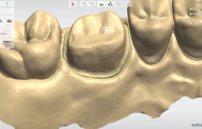 3Shape: tecnologia e innovazione in Dental Class Service