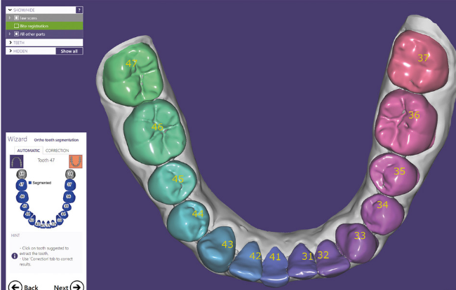 Exocad: tutti i vantaggi del software di modellazione